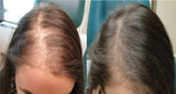 Hair shampoing anti-chute